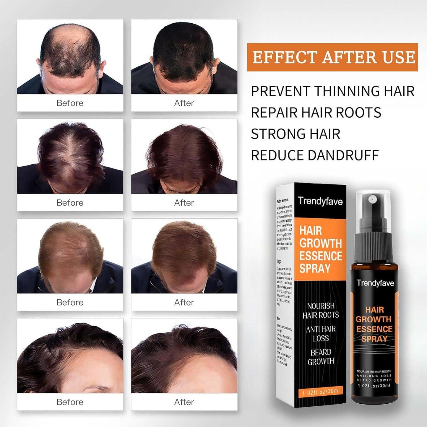 Anti-Drop Hair Lotion Tight Hair Lotion