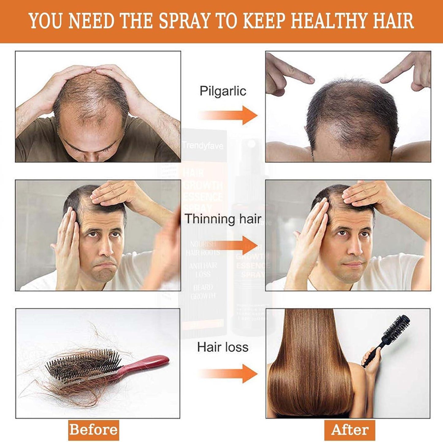 Anti-Drop Hair Lotion Tight Hair Lotion