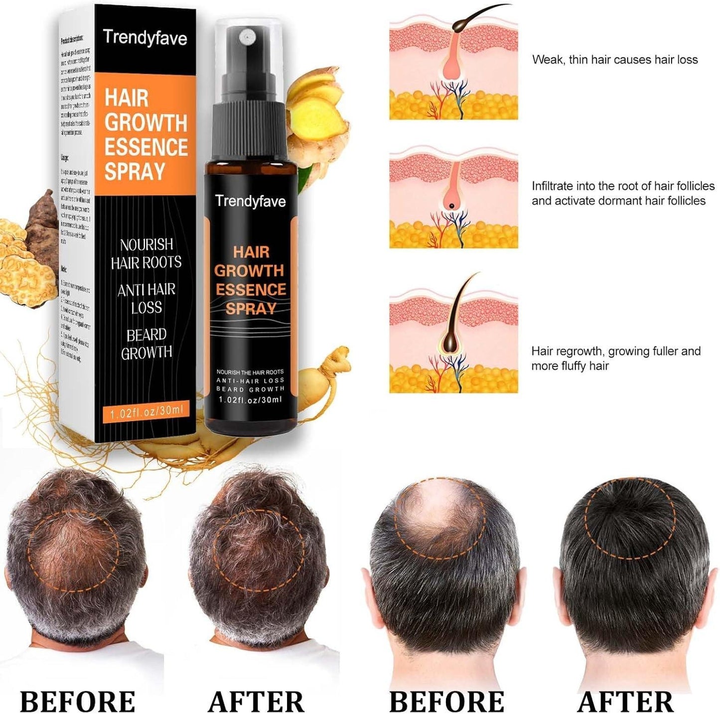 Anti-Drop Hair Lotion Tight Hair Lotion