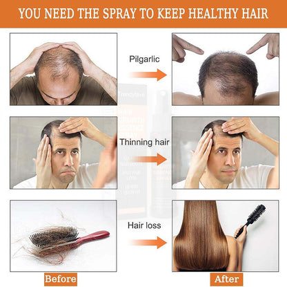 Anti-Drop Hair Lotion Tight Hair Lotion