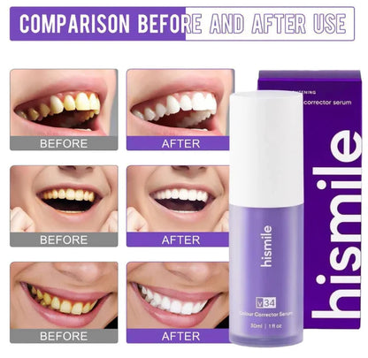 V34 Colour Corrector Serum- Enhance Your Smile